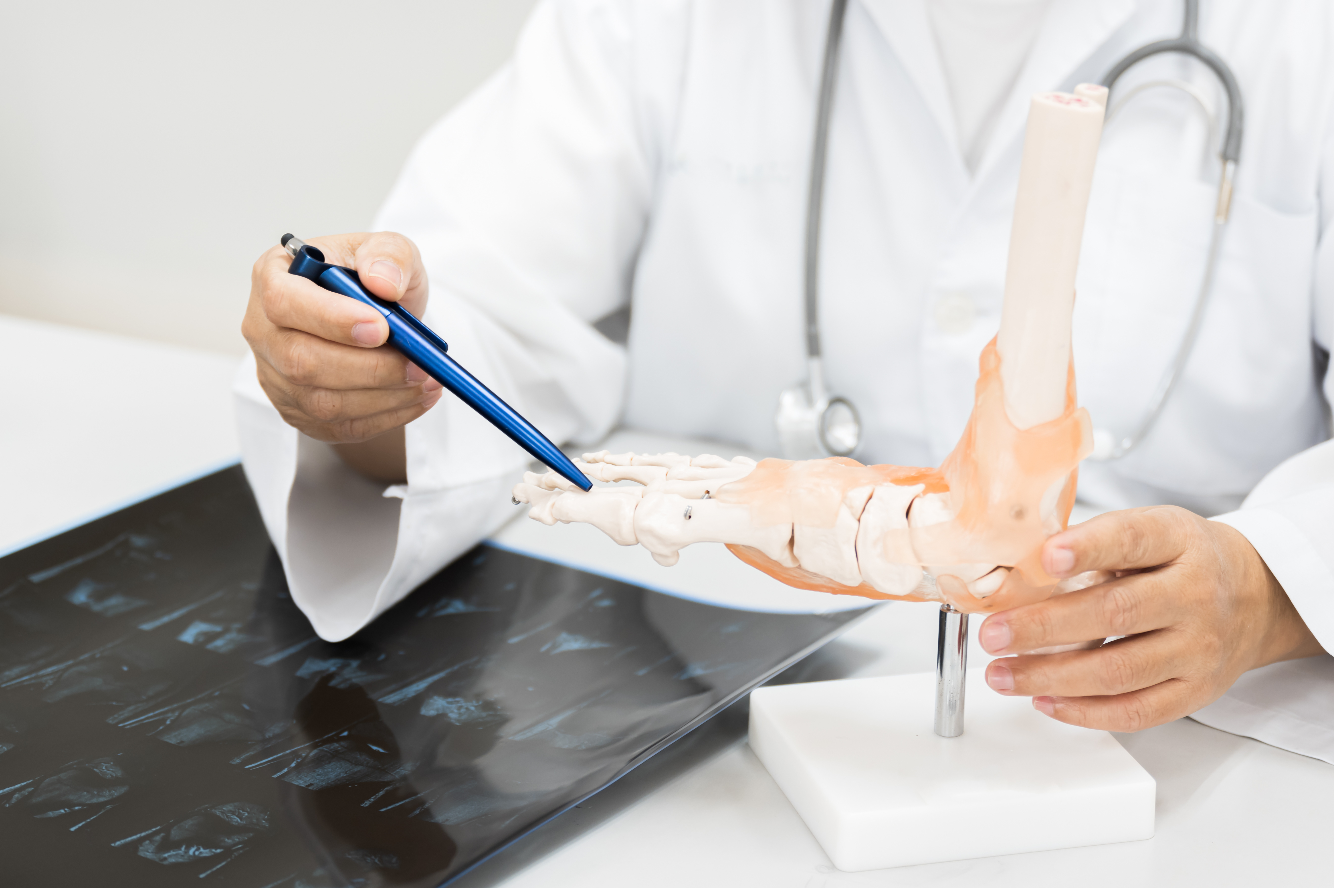 Clinician explaining foot and ankle anatomy using a medical model, illustrating patient education and quality-focused orthopedic care