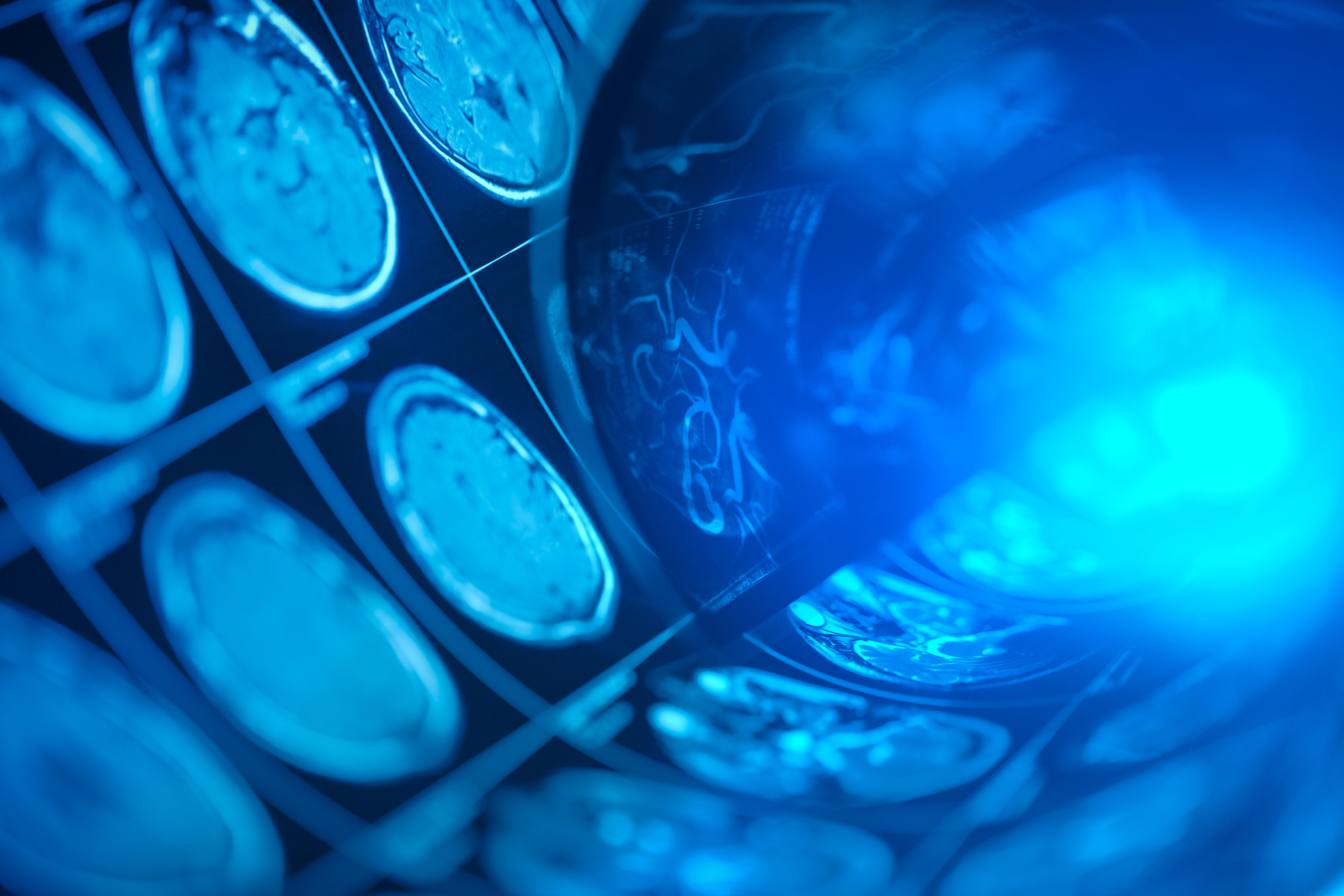 Neurological imaging scans used to support rapid mobile stroke diagnosis and evidence-based prehospital stroke care