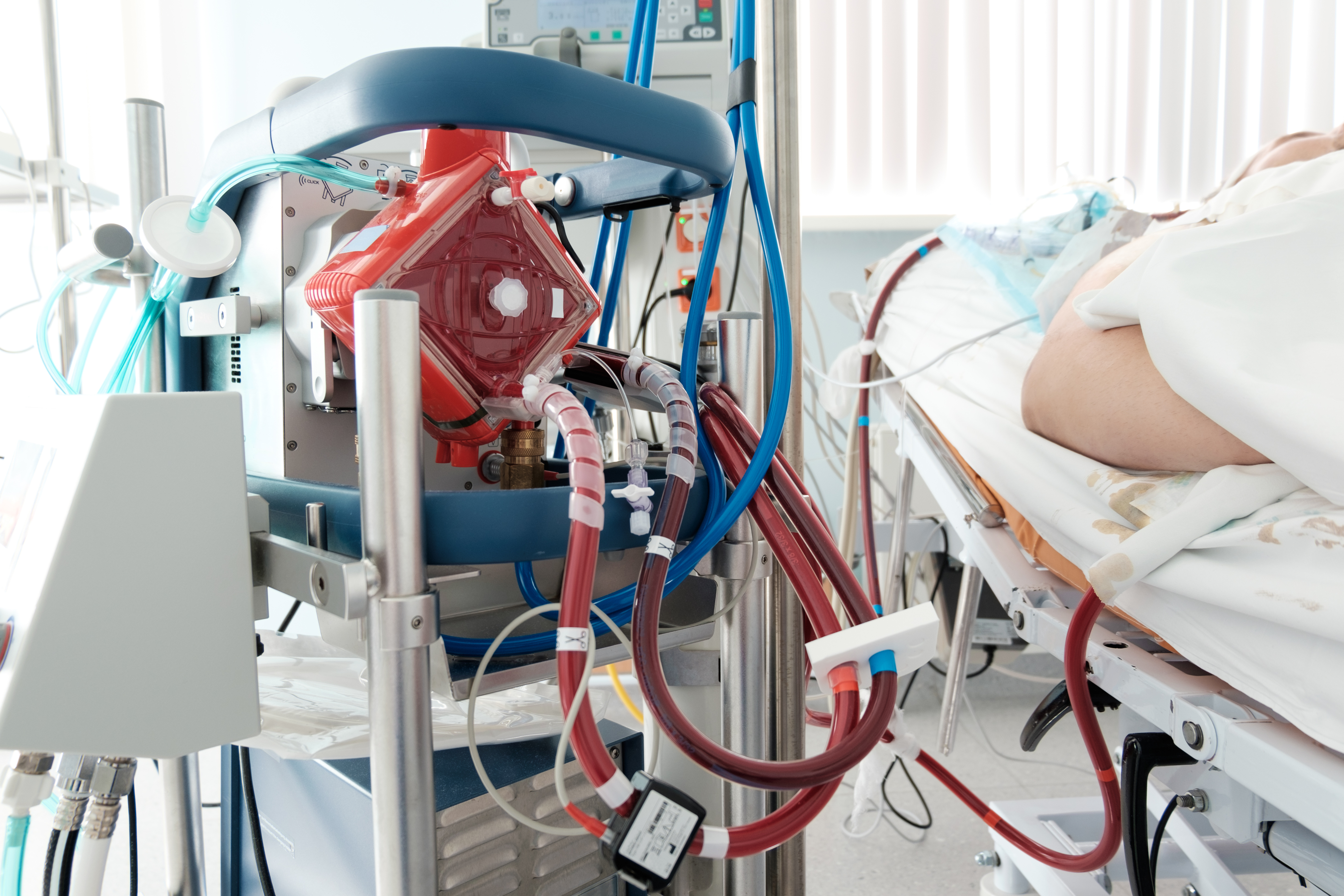 Clinician managing extracorporeal life support tubing for a patient in a hospital meeting DNV ECLS Certification requirements