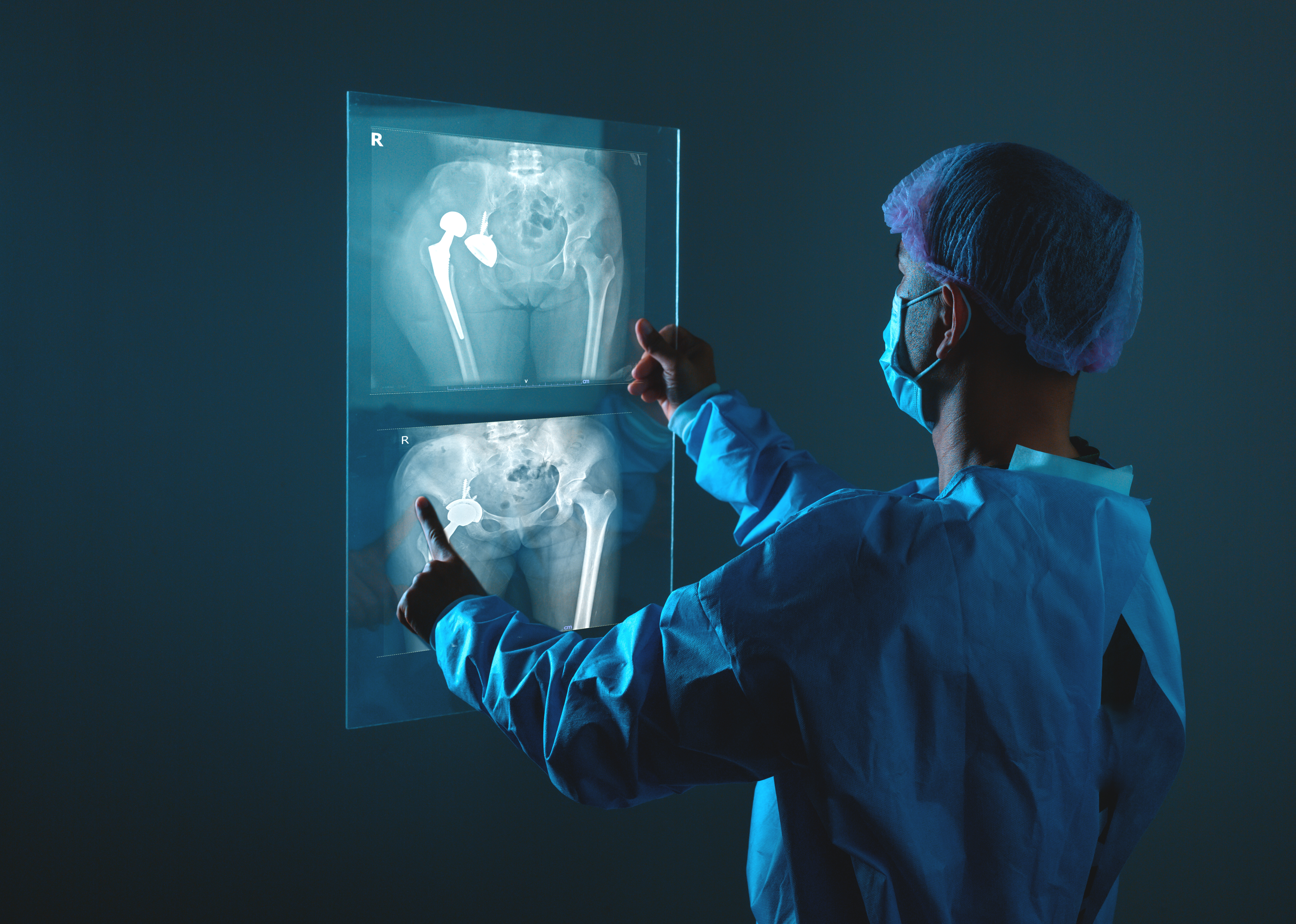 Spine surgeon analysing vertebral X-ray images, representing diagnostic precision and performance standards in DNV’s Advanced Spine Surgery Certification