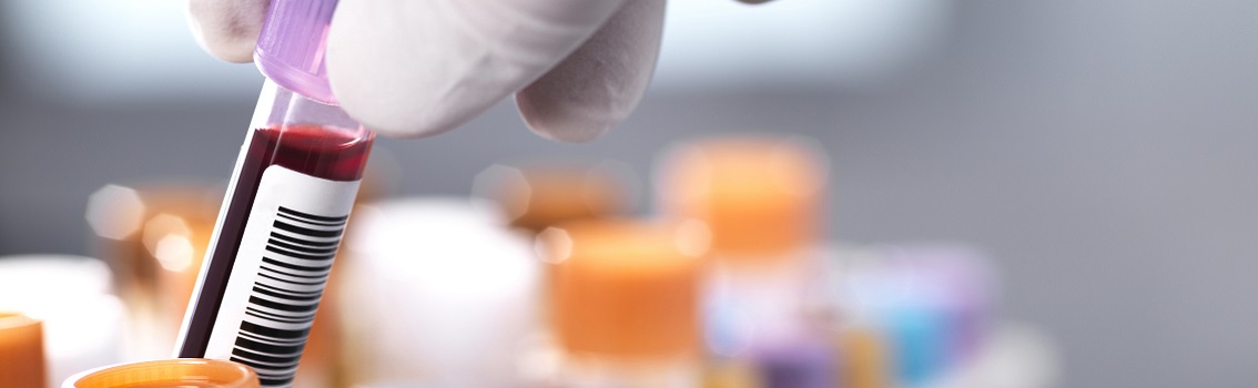 Researcher taking blood sample from a rack of medical samples.