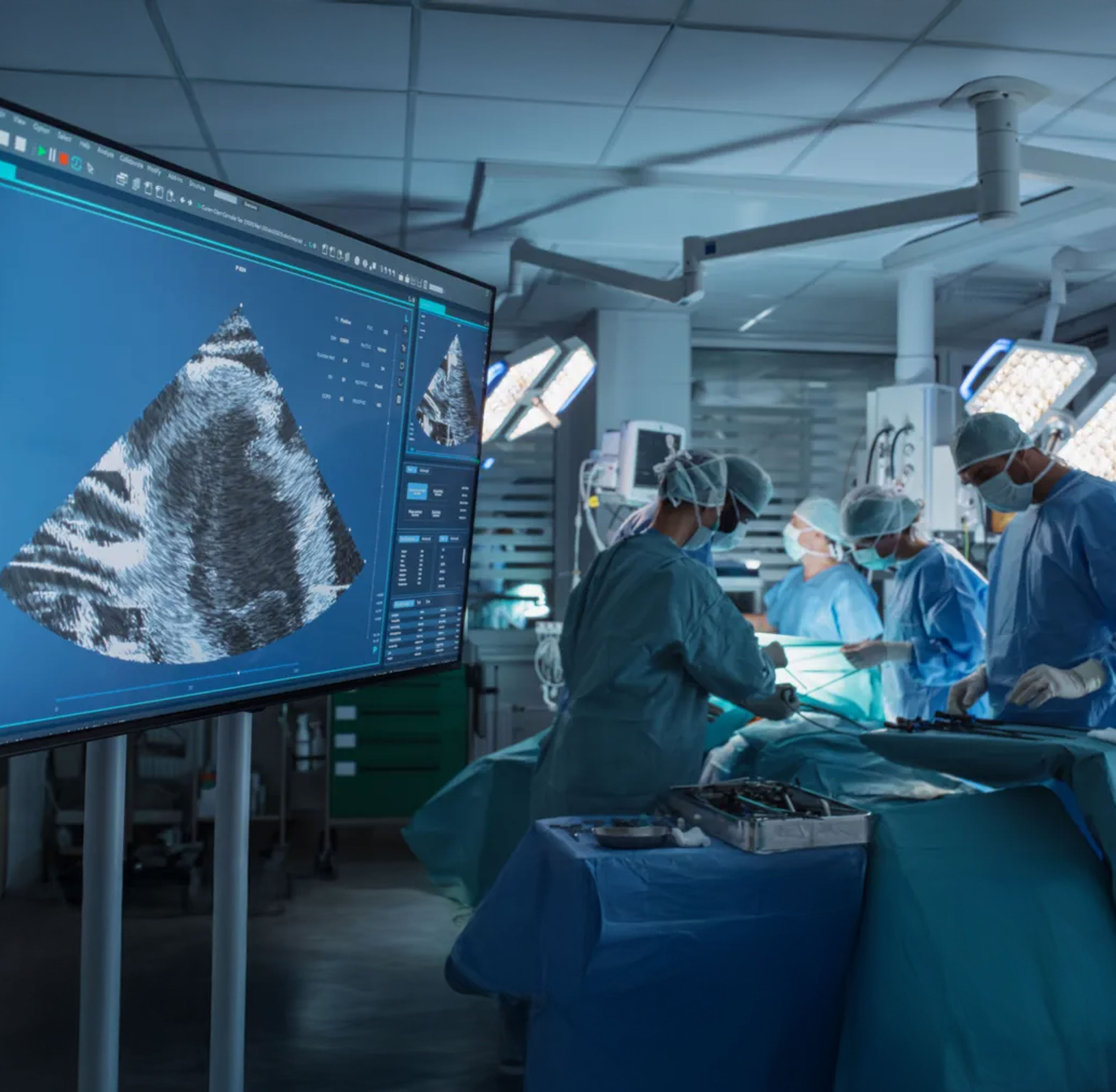 Surgical team performing a procedure in a modern operating room with real-time ultrasound imaging displayed on a large monitor
