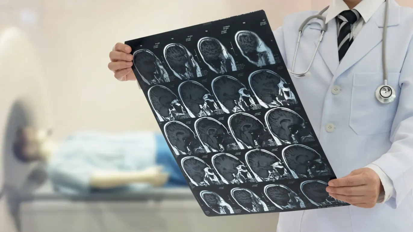 Clinician reviewing stroke patient brain scans to support accurate diagnosis and high-quality stroke care