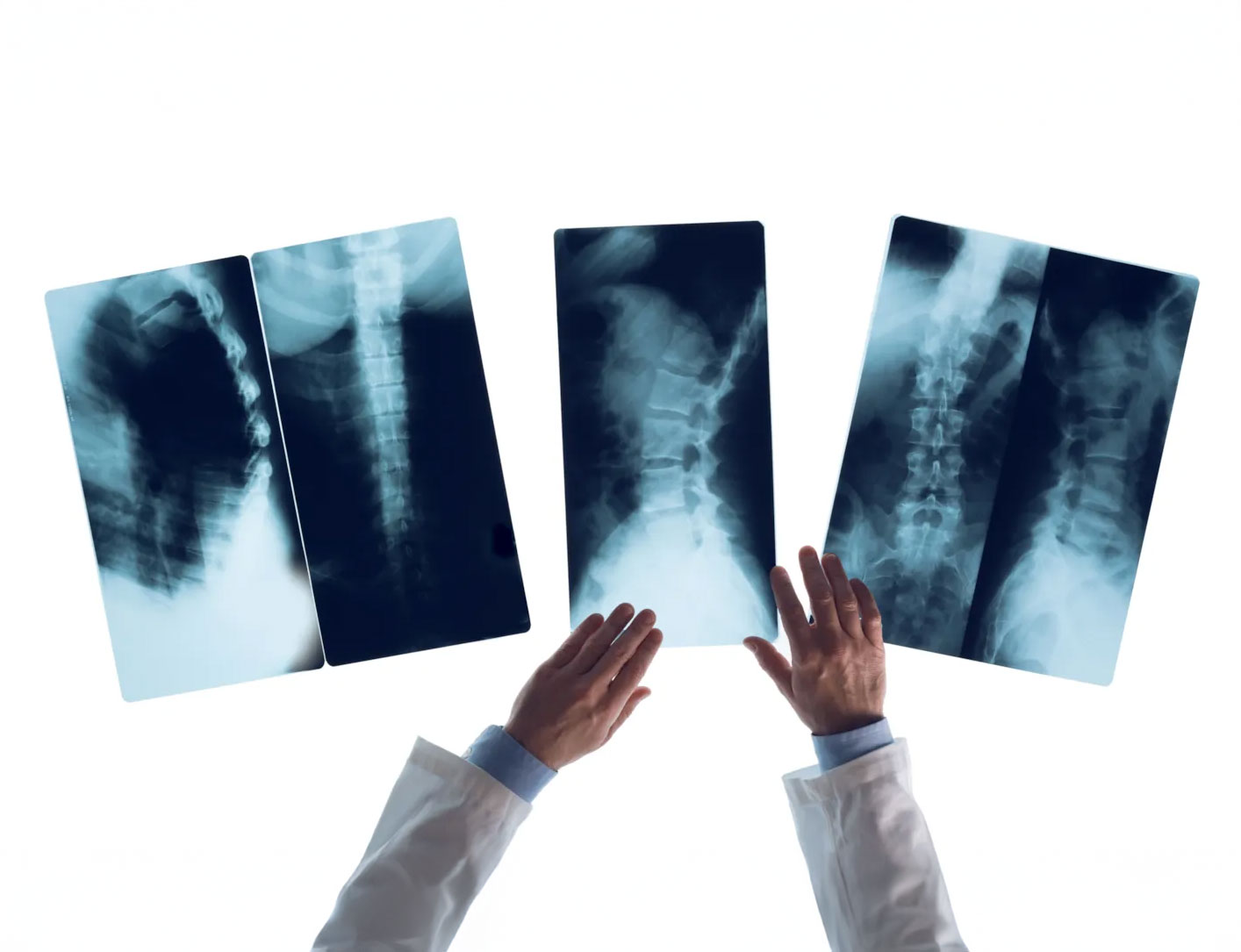 Clinician reviewing multiple orthopaedic X-ray images, reflecting diagnostic evaluation and evidence-based decision-making in musculoskeletal care