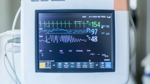 A clinician monitors a patient’s vital signs on a digital cardiac monitor, representing precision and real-time care in advanced chest pain management.
