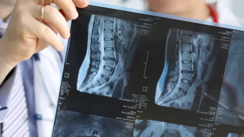 Orthopaedic surgeon examining spinal X-rays with a patient, representing collaboration, clinical expertise, and evidence-based care.