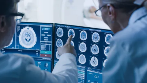 A team of neurologists reviewing brain scan images on a digital screen, representing rapid diagnosis and coordinated acute stroke care.