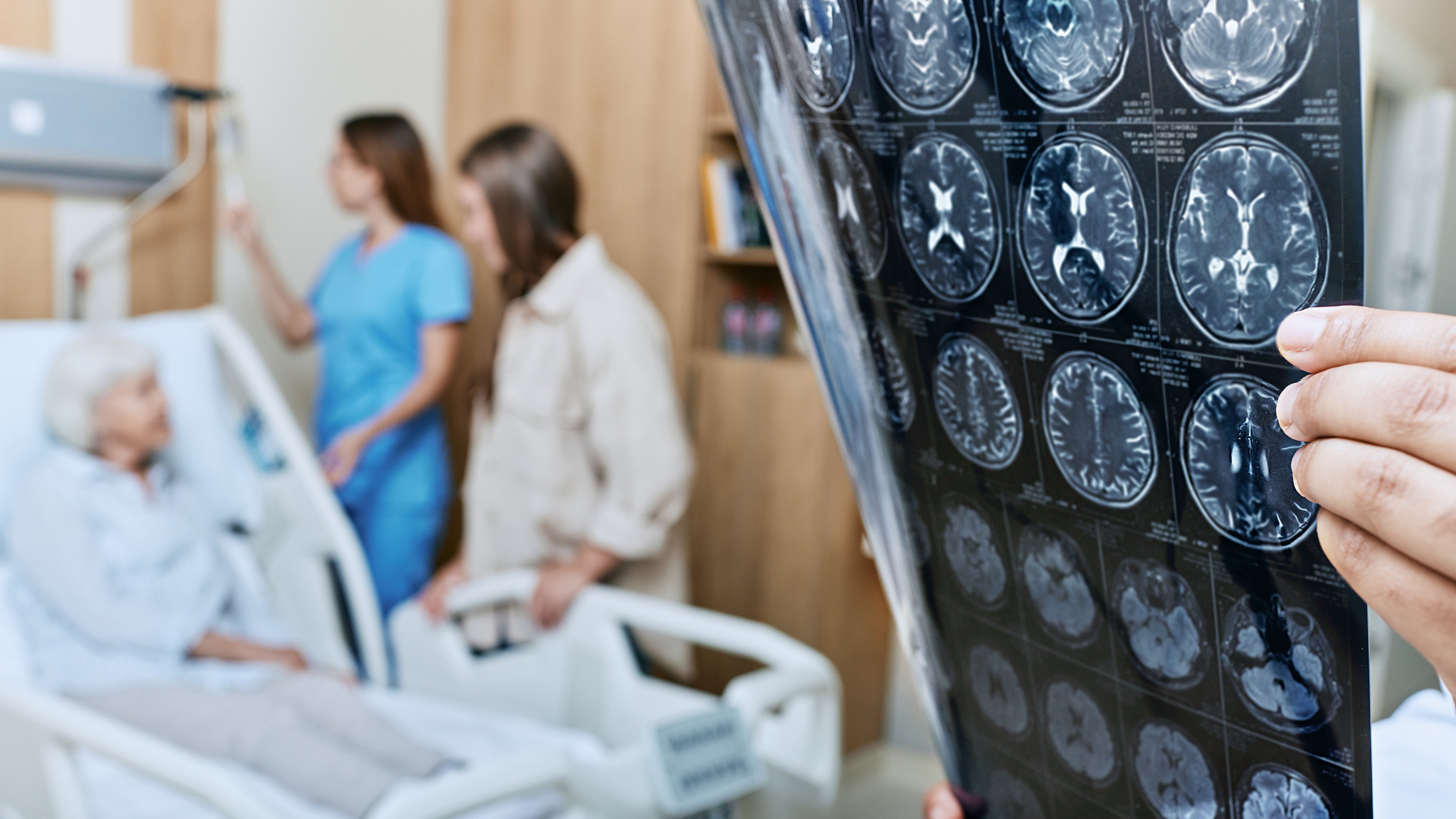 Healthcare professionals reviewing brain scan images in a hospital setting, representing comprehensive stroke care and advanced diagnostic collaboration.