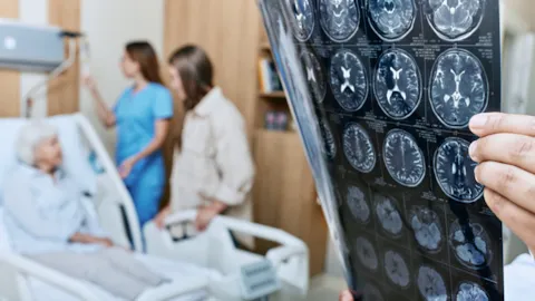Healthcare professionals reviewing brain scan images in a hospital setting, representing comprehensive stroke care and advanced diagnostic collaboration.