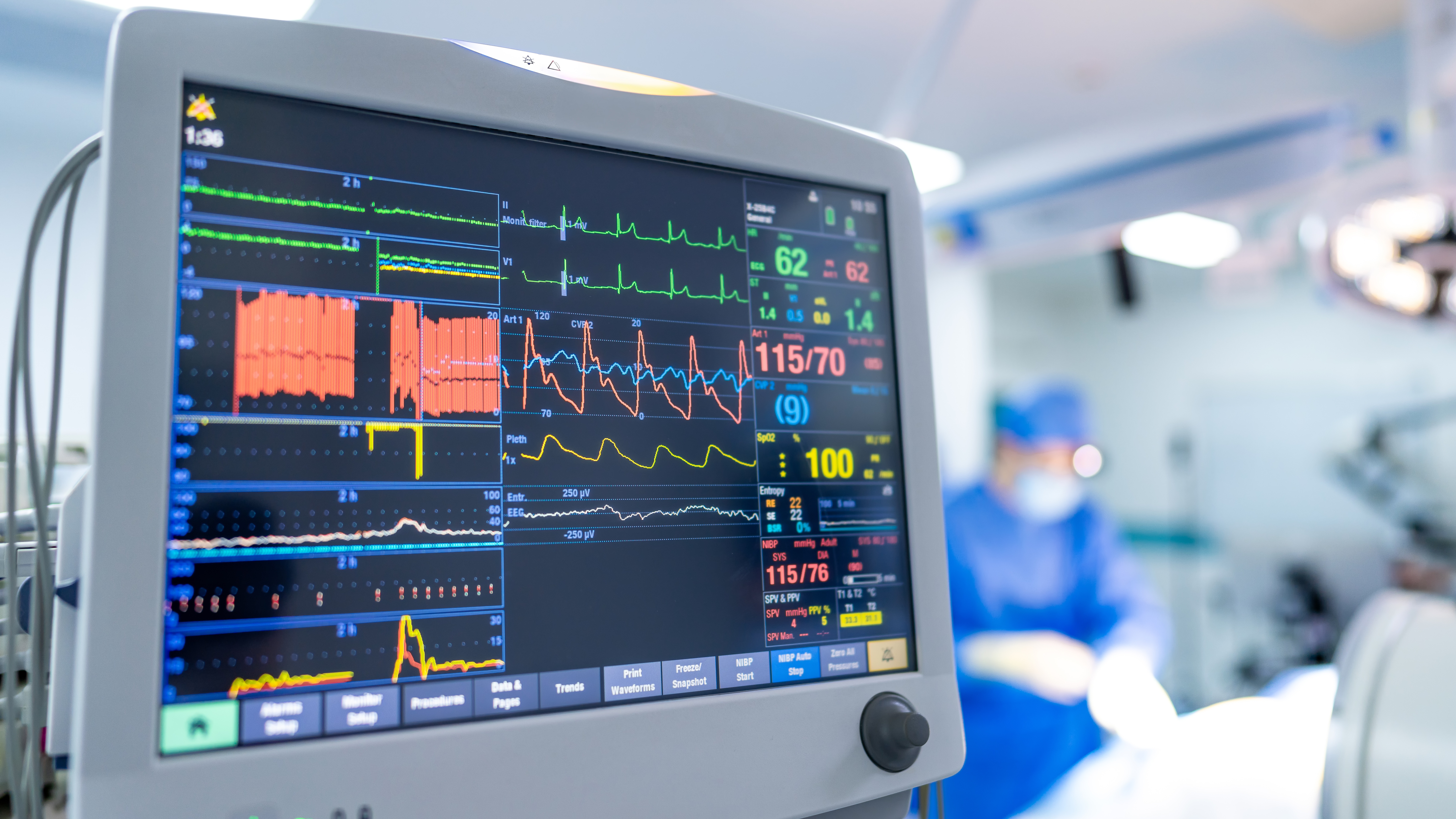 A patient monitoring system displaying vital signs during surgery, representing medical device performance and safety compliance under EU MDR certification.
